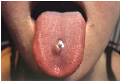 Tongue-Piercing